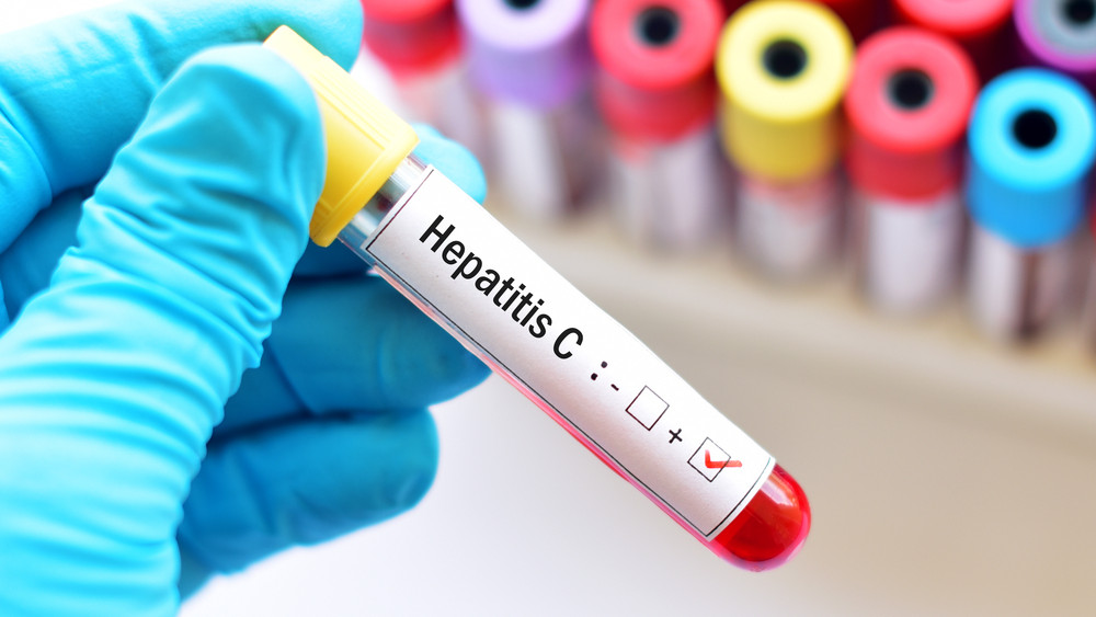 Itt lesz ingyenes hepatitis C-szűrés az országban: mutatjuk a listát!